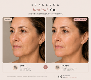 Before and after comparison showing use of the Beaulyco Sculpt Pro LED Face & Neck Massager over 90 days.