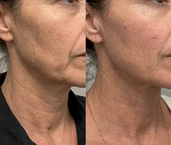 Beaulyco Sculpt Pro